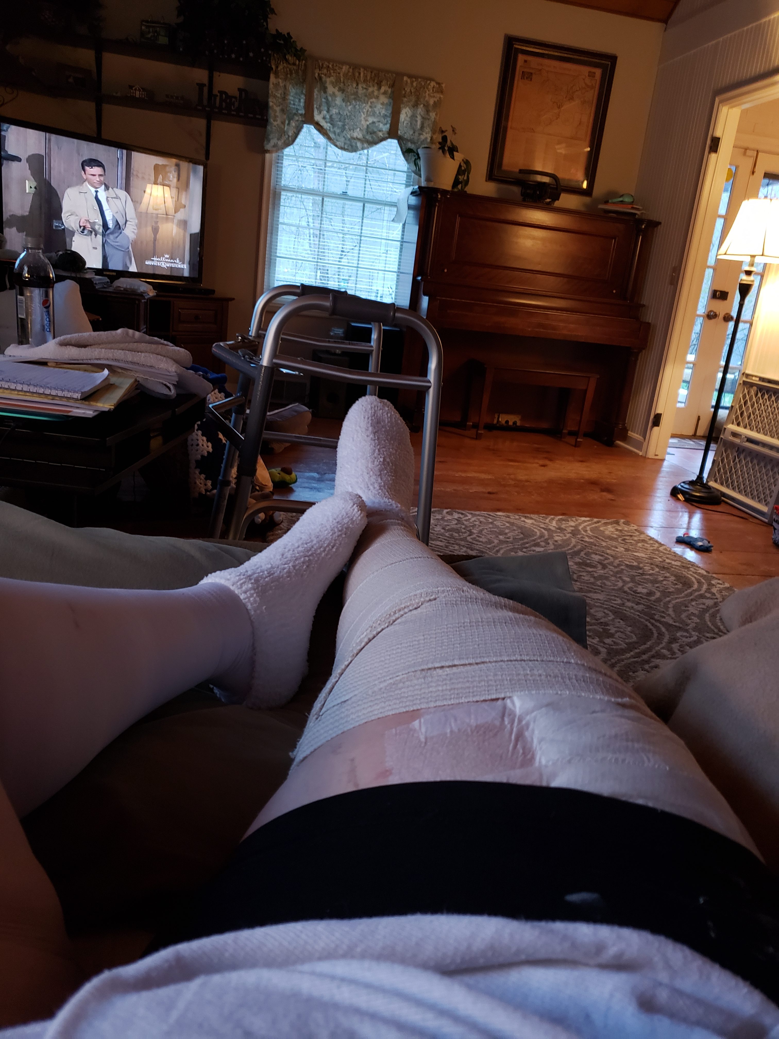 knee replacement surgery week 1